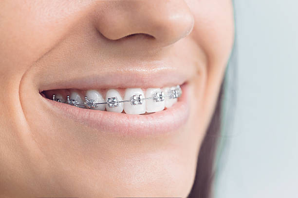 Laser Dentistry in Bonita, CA